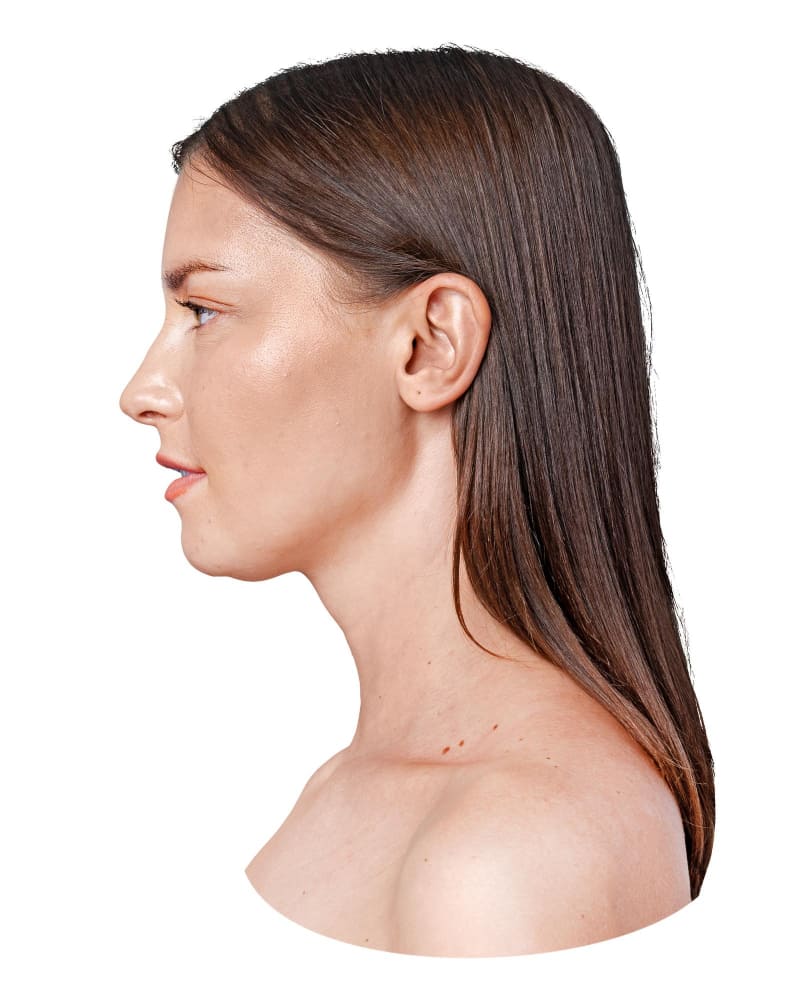 cirugia_feminizacion_facial_ciudad_mexico.jpg